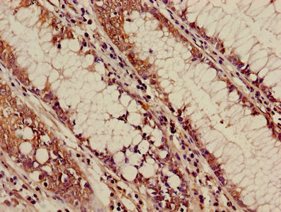 ALOX5 Antibody, HRP conjugated – Figure 1 of 2
