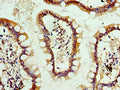 Immunohistochemistry of paraffin-embedded human small intestine tissue using CSB-PA001631ESR2HU at dilution of 1:100