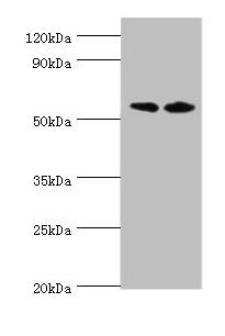 Western blot
All lanes: Alkaline phosphatase, placental type antibody at 8ug/ml
Lane 1: A549 whole cell lysate
Lane 2: Hela whole cell lysate
Secondary
Goat polyclonal to rabbit IgG at 1/10000 dilution
Predicted band size: 58 kDa
Observed band size: 58 kDa