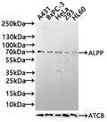 Western blot
All lanes: Alkaline phosphatase, placental type antibody at 6ug/ml
Lane 1: A549 whole cell lysate
Lane 2: Hela whole cell lysate
Secondary
Goat polyclonal to rabbit IgG at 1/10000 dilution
Predicted band size: 58 kDa
Observed band size: 58 kDa