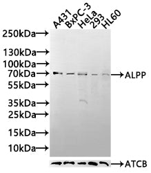 Western blot
All lanes: Alkaline phosphatase, placental type antibody at 6ug/ml
Lane 1: A549 whole cell lysate
Lane 2: Hela whole cell lysate
Secondary
Goat polyclonal to rabbit IgG at 1/10000 dilution
Predicted band size: 58 kDa
Observed band size: 58 kDa