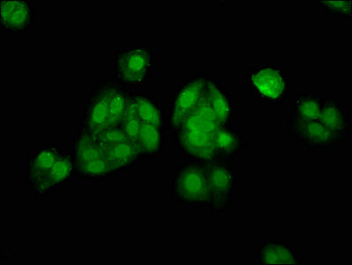 Immunofluorescence staining of HepG2 cells with CSB-PA001646LA01HU at 1:133, counter-stained with DAPI. The cells were fixed in 4% formaldehyde, permeabilized using 0.2% Triton X-100 and blocked in 10% normal Goat Serum. The cells were then incubated with the antibody overnight at 4°C. The secondary antibody was Alexa Fluor 488-congugated AffiniPure Goat Anti-Rabbit IgG(H+L).