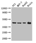 Western Blot
Positive WB detected in: PC-3 whole cell lysate, MCF-7 whole cell lysate, HepG2 whole cell lysate, Mouse brain tissue
All lanes: AMACR antibody at 3ug/ml
Secondary
Goat polyclonal to rabbit IgG at 1/50000 dilution
Predicted band size: 43, 26, 23, 44 kDa
Observed band size: 43 kDa