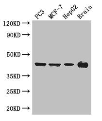 Western Blot
Positive WB detected in: PC-3 whole cell lysate, MCF-7 whole cell lysate, HepG2 whole cell lysate, Mouse brain tissue
All lanes: AMACR antibody at 3ug/ml
Secondary
Goat polyclonal to rabbit IgG at 1/50000 dilution
Predicted band size: 43, 26, 23, 44 kDa
Observed band size: 43 kDa