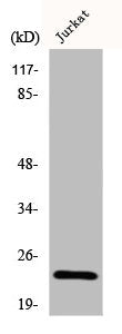 Western Blot analysis of Jurkat cells using Claudin-6 Polyclonal Antibody