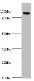 Western blot
All lanes: Angiomotin antibody at 2ug/ml + 293T whole cell lysate
Secondary
Goat polyclonal to rabbit IgG at 1/10000 dilution
Predicted band size: 119, 73 kDa
Observed band size: 119 kDa