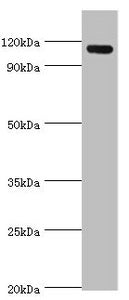 Western blot
All lanes: Angiomotin antibody at 2ug/ml + 293T whole cell lysate
Secondary
Goat polyclonal to rabbit IgG at 1/10000 dilution
Predicted band size: 119, 73 kDa
Observed band size: 119 kDa