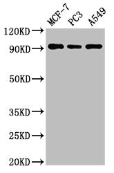 Western Blot
Positive WB detected in: MCF-7 whole cell lysate, PC-3 whole cell lysate, A549 whole cell lysate
All lanes: AMPD1 antibody at 3ug/ml
Secondary
Goat polyclonal to rabbit IgG at 1/50000 dilution
Predicted band size: 91, 90 kDa
Observed band size: 91 kDa