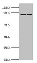 Western blot
All lanes: AMP deaminase 3 antibody at 2ug/ml
Lane 1: NIH/3T3 whole cell lysate
Lane 2: 293T whole cell lysate
Lane 3: Mouse lung tissue
Secondary
Goat polyclonal to rabbit IgG at 1/10000 dilution
Predicted band size: 89, 25, 77, 90, 72 kDa
Observed band size: 89 kDa
