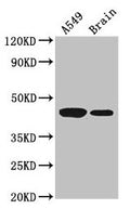 Western Blot
Positive WB detected in: A549 whole cell lysate, Mouse brain tissue
All lanes: AMT antibody at 3.5µg/ml
Secondary
Goat polyclonal to rabbit IgG at 1/50000 dilution
Predicted band size: 44, 38, 40, 42 kDa
Observed band size: 44 kDa