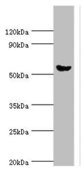 Western blot
All lanes: Pancreatic alpha-amylase antibody at 6ug/ml + Mouse liver tissue
Secondary
Goat polyclonal to rabbit IgG at 1/10000 dilution
Predicted band size: 58, 31 kDa
Observed band size: 58 kDa