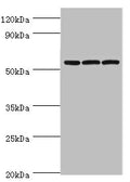 Western blot
All lanes: Alpha-amylase 2B antibody at 8ug/ml
Lane 1: Mouse skeletal muscle tissue
Lane 2: HL60 whole cell lysate
Lane 3: K562 whole cell lysate
Secondary
Goat polyclonal to rabbit IgG at 1/10000 dilution
Predicted band size: 58, 43 kDa
Observed band size: 58 kDa