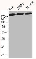 Western Blot analysis of 823 22RV1 293-UV cells using COL1A2 Polyclonal Antibody