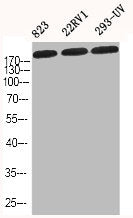 Western Blot analysis of 823 22RV1 293-UV cells using COL1A2 Polyclonal Antibody