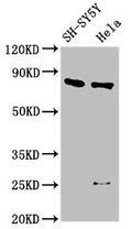 Western Blot
Positive WB detected in: SH-SY5Y whole cell lysate, Hela whole cell lysate
All lanes: CTNNB1 antibody at 2.5µg/ml
Secondary
Goat polyclonal to rabbit IgG at 1/50000 dilution
Predicted band size: 86 kDa
Observed band size: 86 kDa