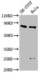 Western Blot
Positive WB detected in: SH-SY5Y whole cell lysate, Hela whole cell lysate
All lanes: CTNNB1 antibody at 2.5µg/ml
Secondary
Goat polyclonal to rabbit IgG at 1/50000 dilution
Predicted band size: 86 kDa
Observed band size: 86 kDa