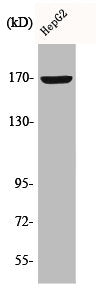 Western Blot analysis of HepG2 cells using COL4A6 Polyclonal Antibody