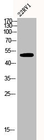 Western Blot analysis of 22RV1 cells using Csk Polyclonal Antibody