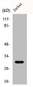 Western Blot analysis of HuvEc cells using CTDSP1 Polyclonal Antibody