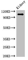 Western Blot
Positive WB detected in: Mouse kidney tissue
All lanes: ANPEP antibody at 3.4µg/ml
Secondary
Goat polyclonal to rabbit IgG at 1/50000 dilution
Predicted band size: 110 kDa
Observed band size: 110 kDa