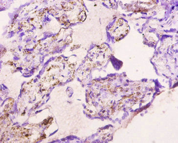 Immunohistochemistry of paraffin-embedded human placenta tissue using CSB-PA001909NJ01HU at dilution of 1:10