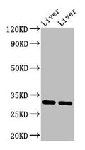 Western Blot
Positive WB detected in: Rat liver tissue, Mouse liver tissue
All lanes: APOA1 antibody at 3.4µg/ml
Secondary
Goat polyclonal to rabbit IgG at 1/50000 dilution
Predicted band size: 31 kDa
Observed band size: 31 kDa