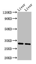 Western Blot
Positive WB detected in: Rat liver tissue, Mouse liver tissue
All lanes: APOA1 antibody at 3.4µg/ml
Secondary
Goat polyclonal to rabbit IgG at 1/50000 dilution
Predicted band size: 31 kDa
Observed band size: 31 kDa