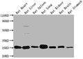 Western Blot
Positive WB detected in: Rat Heart tissue, Rat Liver tissue, Rat Spleen tissue, Rat Lung tissue, Rat Kidney tissue, Rat Brain tissue, Rat Stomach tissue
All lanes: Apoa1 antibody at 1:2000
Secondary
Goat polyclonal to rabbit IgG at 1/50000 dilution
Predicted band size: 31 kDa
Observed band size: 31 kDa
