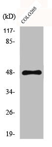 Western Blot analysis of COLO205 cells using CYP11B1/2 Polyclonal Antibody