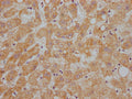 IHC image of CSB-PA001930NA01HU diluted at 1:200 and staining in paraffin-embedded human liver tissue performed on a Leica BondTM system. After dewaxing and hydration, antigen retrieval was mediated by high pressure in a citrate buffer (pH 6.0). Section was blocked with 10% normal goat serum 30min at RT. Then primary antibody (1% BSA) was incubated at 4°C overnight. The primary is detected by a Goat anti-rabbit IgG labeled by HRP and visualized using 0.05% DAB.