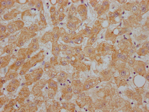 IHC image of CSB-PA001930NA01HU diluted at 1:200 and staining in paraffin-embedded human liver tissue performed on a Leica BondTM system. After dewaxing and hydration, antigen retrieval was mediated by high pressure in a citrate buffer (pH 6.0). Section was blocked with 10% normal goat serum 30min at RT. Then primary antibody (1% BSA) was incubated at 4°C overnight. The primary is detected by a Goat anti-rabbit IgG labeled by HRP and visualized using 0.05% DAB.