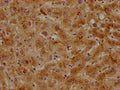 IHC image of CSB-PA001932OA01HU diluted at 1:500 and staining in paraffin-embedded human liver tissue performed on a Leica BondTM system. After dewaxing and hydration, antigen retrieval was mediated by high pressure in a citrate buffer (pH 6.0). Section was blocked with 10% normal goat serum 30min at RT. Then primary antibody (1% BSA) was incubated at 4°C overnight. The primary is detected by a biotinylated secondary antibody and visualized using an HRP conjugated SP system.