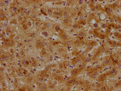 IHC image of CSB-PA001932OA01HU diluted at 1:500 and staining in paraffin-embedded human liver tissue performed on a Leica BondTM system. After dewaxing and hydration, antigen retrieval was mediated by high pressure in a citrate buffer (pH 6.0). Section was blocked with 10% normal goat serum 30min at RT. Then primary antibody (1% BSA) was incubated at 4°C overnight. The primary is detected by a biotinylated secondary antibody and visualized using an HRP conjugated SP system.