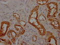 IHC image of CSB-PA001947LA01HU diluted at 1:100 and staining in paraffin-embedded human kidney tissue performed on a Leica BondTM system. After dewaxing and hydration, antigen retrieval was mediated by high pressure in a citrate buffer (pH 6.0). Section was blocked with 10% normal goat serum 30min at RT. Then primary antibody (1% BSA) was incubated at 4°C overnight. The primary is detected by a Goat anti-rabbit IgG labeled by HRP and visualized using 0.05% DAB.