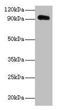 Western blot
All lanes: APP antibody at 2µg/ml + HL60 whole cell lysate
Secondary
Goat polyclonal to rabbit IgG at 1/10000 dilution
Predicted band size: 87, 35, 77, 79, 81, 83, 85, 86, 73 kDa
Observed band size: 95 kDa