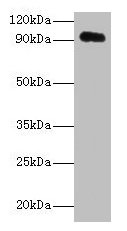 Western blot
All lanes: APP antibody at 2µg/ml + HL60 whole cell lysate
Secondary
Goat polyclonal to rabbit IgG at 1/10000 dilution
Predicted band size: 87, 35, 77, 79, 81, 83, 85, 86, 73 kDa
Observed band size: 95 kDa