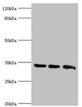 Western blot
All lanes: Aquaporin-4 antibody at 2ug/ml
Lane 1: Mouse brain tissue
Lane 2: Mouse heart tissue
Lane 3: Mouse kidney tissue
Secondary
Goat polyclonal to rabbit IgG at 1/10000 dilution
Predicted band size: 35, 33 kDa
Observed band size: 35 kDa