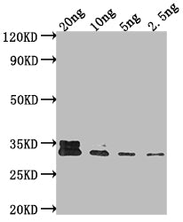 Western Blot
Positive WB detected in Recombinant protein
All lanes: AR antibody at 1:2000
Secondary
Goat polyclonal to rabbit IgG at 1/50000 dilution
Predicted band size: 35.7 kDa
Observed band size: 34 kDa