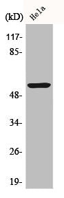 Western Blot analysis of HeLa cells using Cytokeratin 10 Polyclonal Antibody