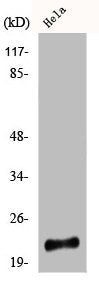 Western Blot analysis of COLO205 cells using DJ-1 Polyclonal Antibody