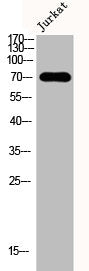 Western Blot analysis of Jurkat cells using DMPK Polyclonal Antibody