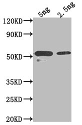 Western Blot
Positive WB detected in Recombinant protein
All lanes: ASGR2 antibody at 1:2000
Secondary
Goat polyclonal to rabbit IgG at 1/50000 dilution
Predicted band size: 45.9 kDa
Observed band size: 52 kDa
