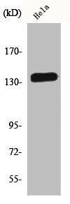 Western Blot analysis of HeLa cells using E-cadherin Polyclonal Antibody