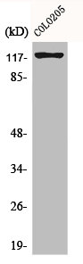 Western Blot analysis of COLO205 cells using Eg5 Polyclonal Antibody