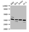 Western Blot
Positive WB detected in: K562 whole cell lysate, Hela whole cell lysate, Jurkat whole cell lysate, PC-3 whole cell lysate
All lanes: ATG3 antibody at 4µg/ml
Secondary
Goat polyclonal to rabbit IgG at 1/50000 dilution
Predicted band size: 36 kDa
Observed band size: 36 kDa