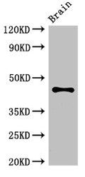 Western Blot
Positive WB detected in: Mouse brain tissue
All lanes: ATG4B antibody at 3.4ug/ml
Secondary
Goat polyclonal to rabbit IgG at 1/50000 dilution
Predicted band size: 45, 53, 32, 38, 43 kDa
Observed band size: 45 kDa
