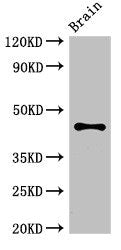 Western Blot
Positive WB detected in: Mouse brain tissue
All lanes: ATG4B antibody at 3.4ug/ml
Secondary
Goat polyclonal to rabbit IgG at 1/50000 dilution
Predicted band size: 45, 53, 32, 38, 43 kDa
Observed band size: 45 kDa