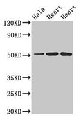 Western Blot
Positive WB detected in: Hela whole cell lysate, Rat heart tissue, Mouse heart tissue
All lanes: ATP1B1 antibody at 3µg/ml
Secondary
Goat polyclonal to rabbit IgG at 1/50000 dilution
Predicted band size: 36, 35 kDa
Observed band size: 52 kDa