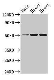 Western Blot
Positive WB detected in: Hela whole cell lysate, Rat heart tissue, Mouse heart tissue
All lanes: ATP1B1 antibody at 3µg/ml
Secondary
Goat polyclonal to rabbit IgG at 1/50000 dilution
Predicted band size: 36, 35 kDa
Observed band size: 52 kDa