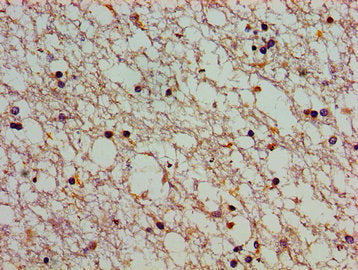 Immunohistochemistry of paraffin-embedded human brain tissue using CSB-PA002339LA01HU at dilution of 1:100